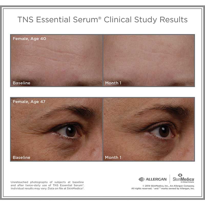 TNS Essential Serum Clinical Study Results