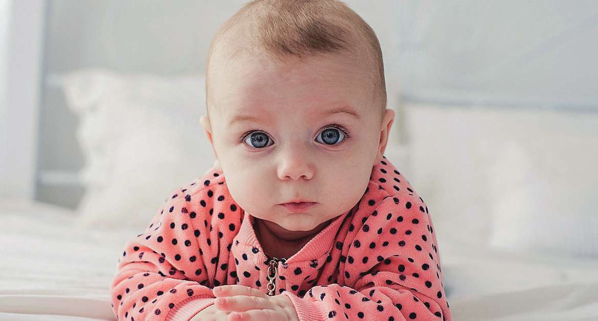 Infantile hemangiomas (strawberry birthmarks)