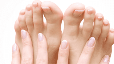 Splitting Fingertips Skin Fissures - Advanced Dermatology Omaha