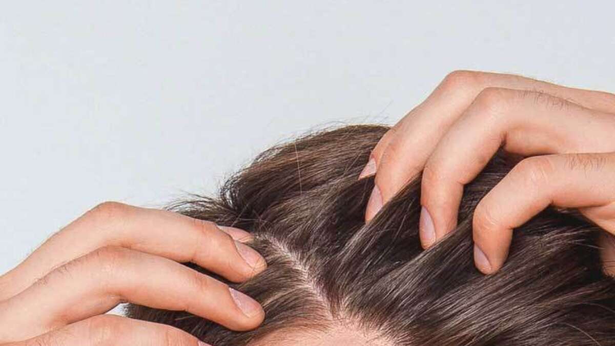 Itchy Scalp | Advanced Dermatology of the Midlands in Omaha