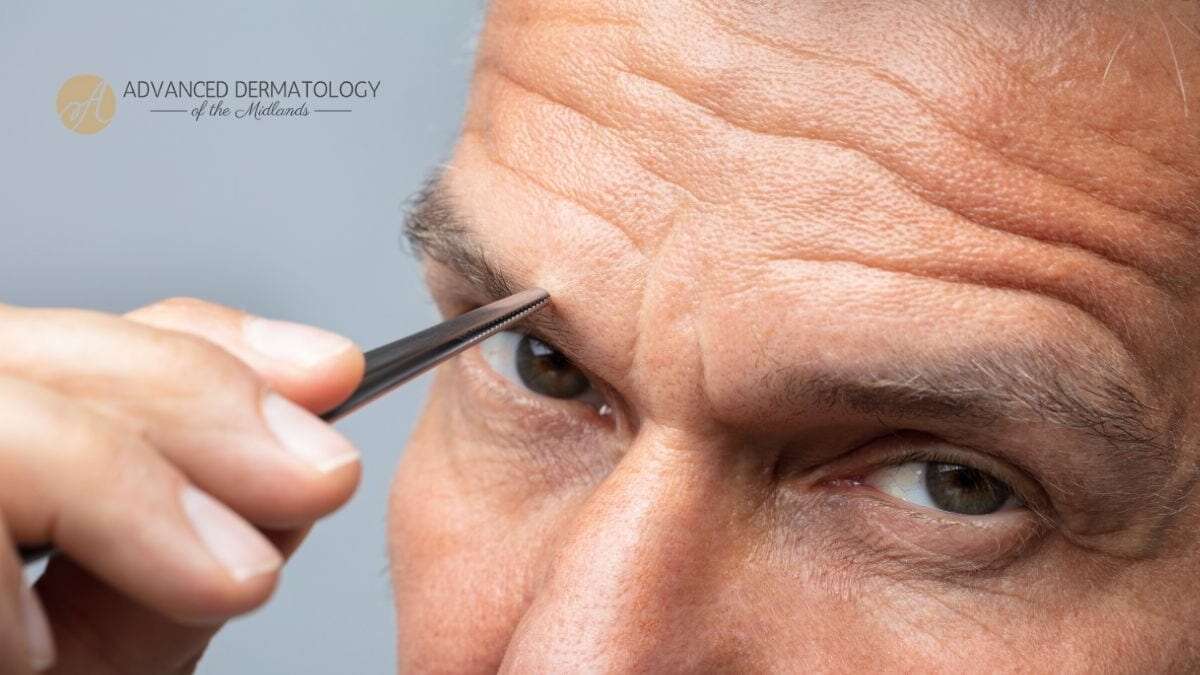 Top more than 148 forehead hair growth oil latest dedaotaonec