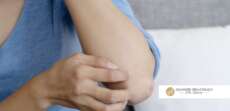 itching without rash